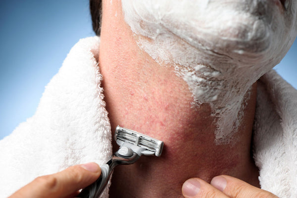 How to Prevent Razor Bumps and Remove Ingrown Hairs