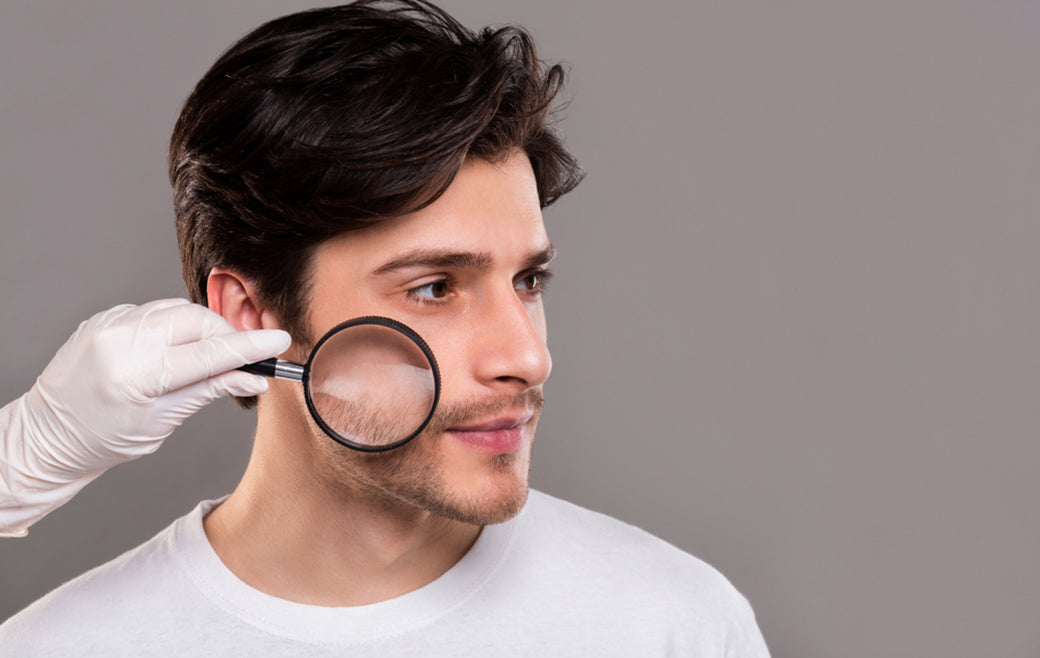 a dermatologist inspecting a young mans facial skin