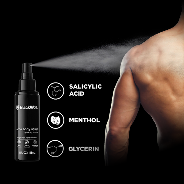 Acne Body Spray - SAVE 50% TODAY!